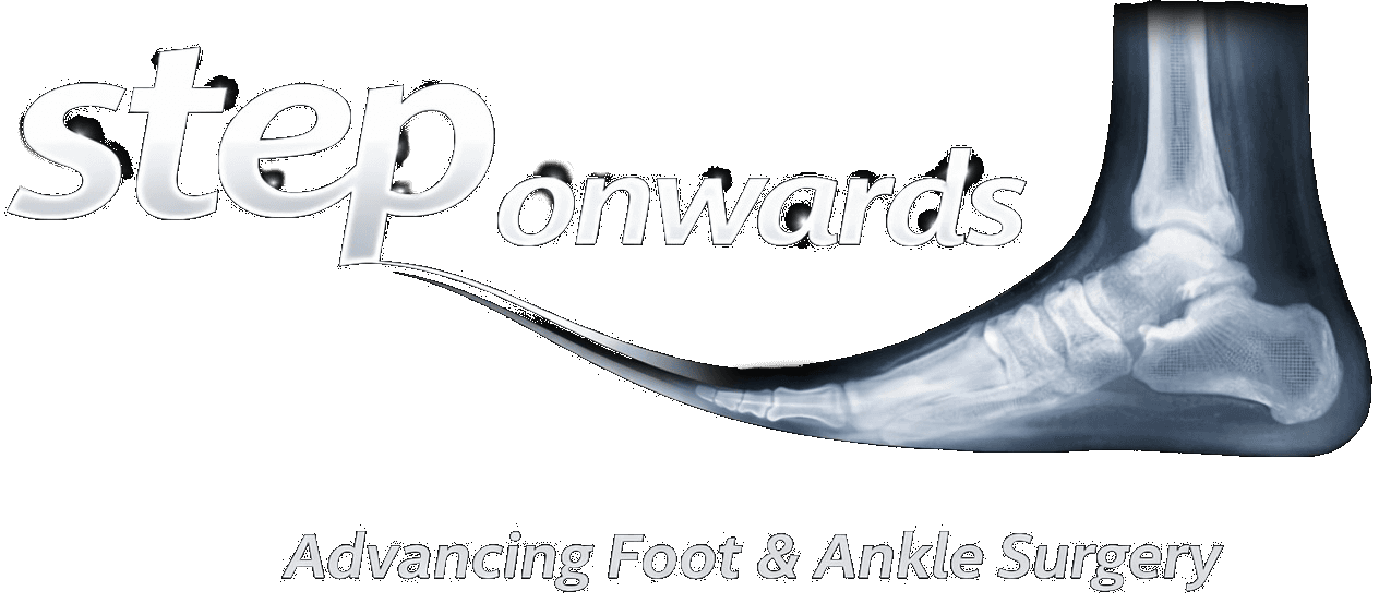 Steponwards - Advancing Foot & Ankle Surgery